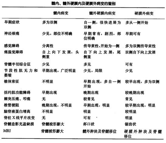 髓内病变,髓外硬膜内病变和硬膜外病变的鉴别要点见下表