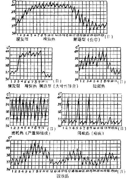 发热常见的热型有__________,__________,__________,__________.