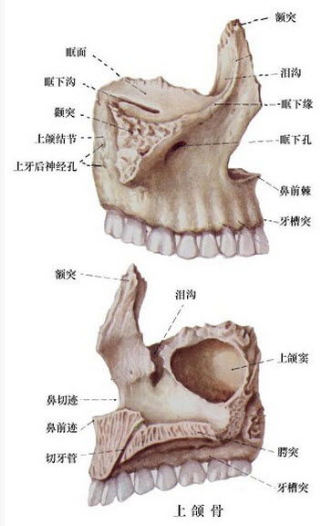 凿骨进入上颌窦的手术途径是()