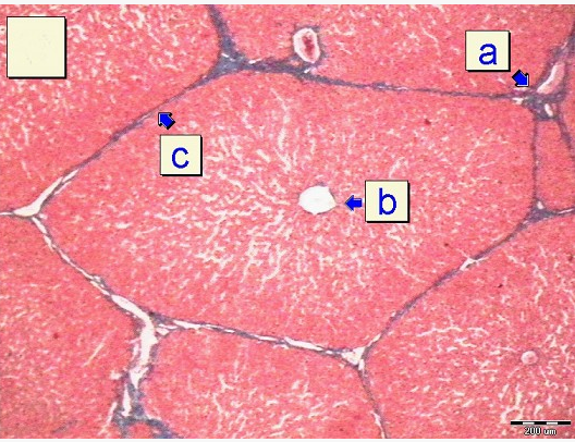 如圖所示其中箭頭b所指的結構為a中央動脈b中央靜脈c小葉間動脈d小葉